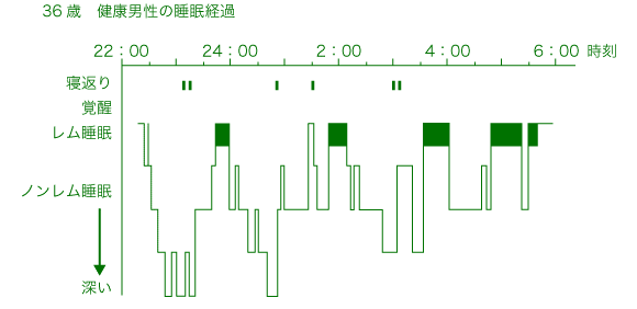 36歳健康男性の睡眠経過