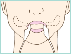 スリムホホ装着方法イラスト3