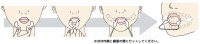 スリムホホ　セッティングイメージ図　ほほ内側と歯茎の間にセットして下さい。